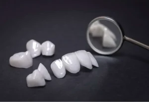 Estetica dental clinica valencia