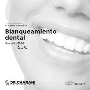 blanqueamiento-dental