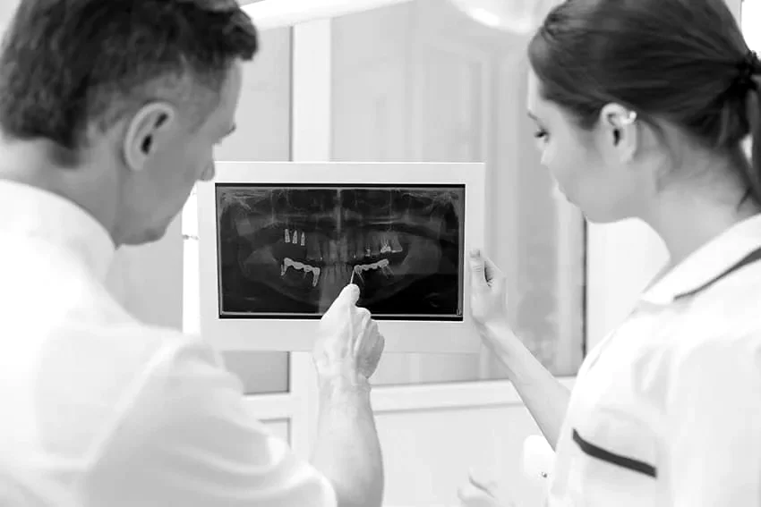implantes-dentales