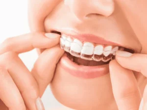 invisalign-valencia