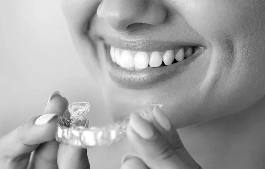 Invisalign