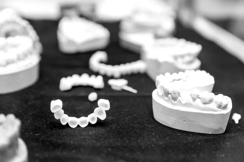 implantes-dentales