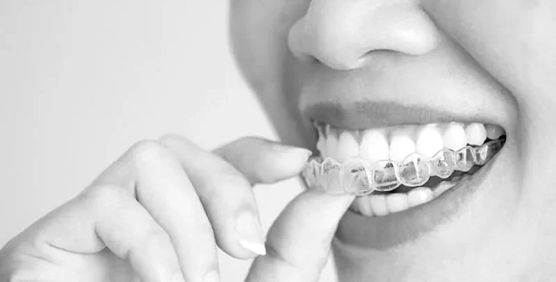 invisalign-en-valencia