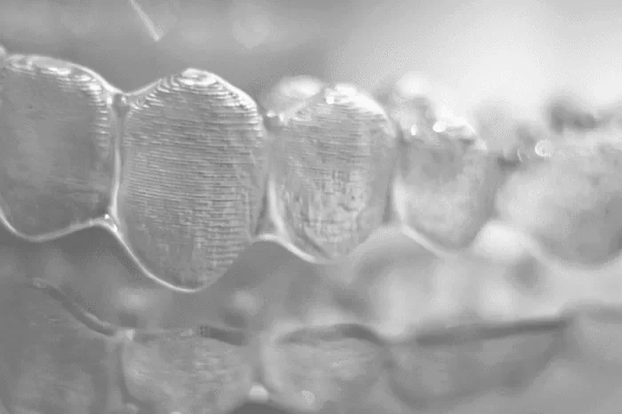 Razones por las que optar por una odontología invisible