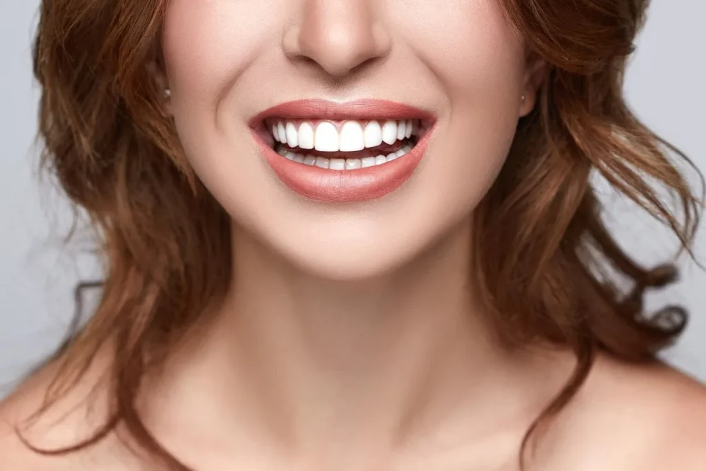 Blanqueamiento dental: