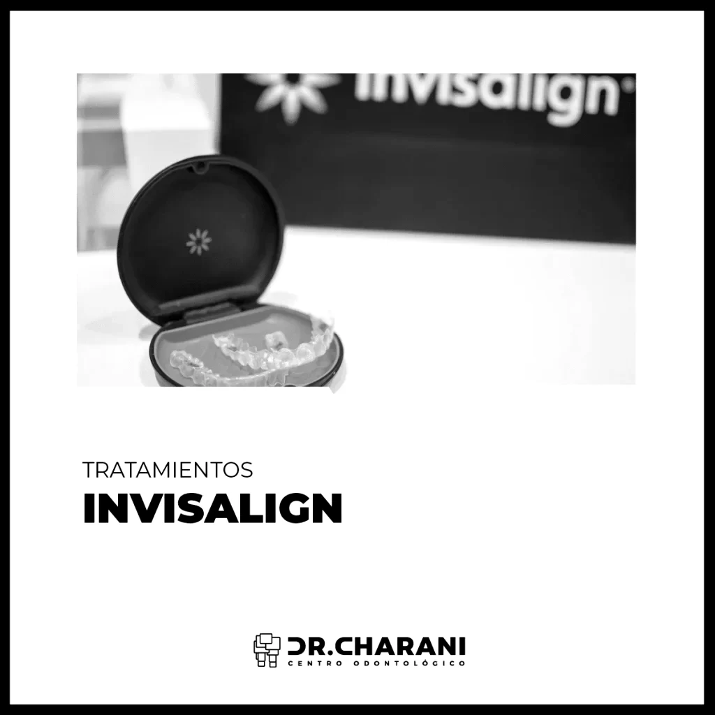 Invisalign o brackets