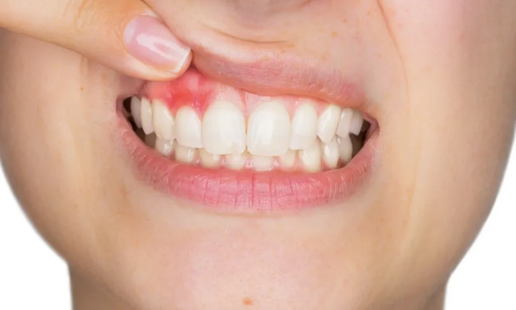 Urgencias dentales