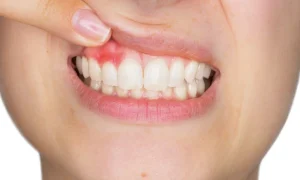Urgencias dentales