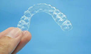 Tipos de ortodoncia invisible