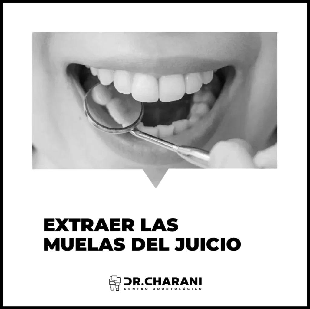 ¿Qué es la cirugía de cordales en Valencia?