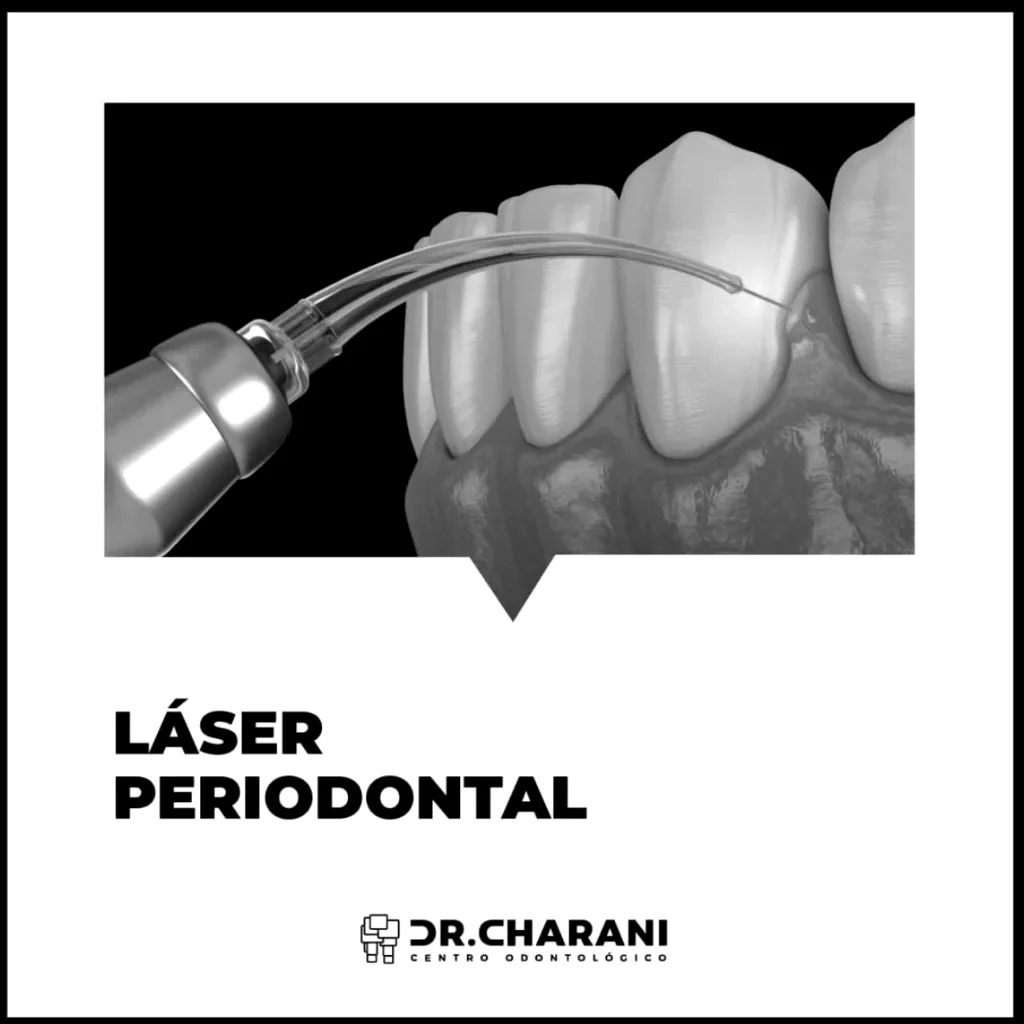 Conoce cómo es un tratamiento de periodoncia