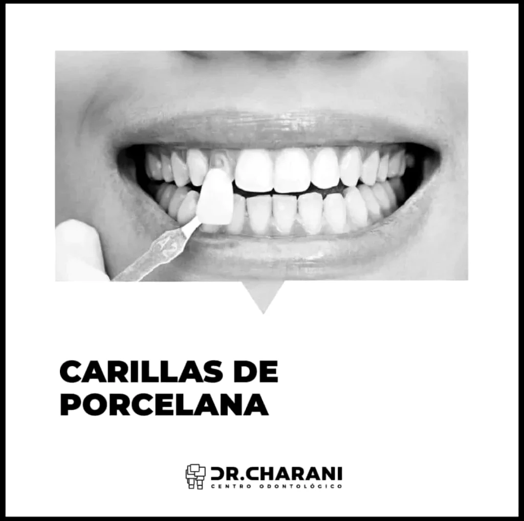 Estética dental en Valencia