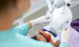 Cuál es el mejor blanqueamiento dental