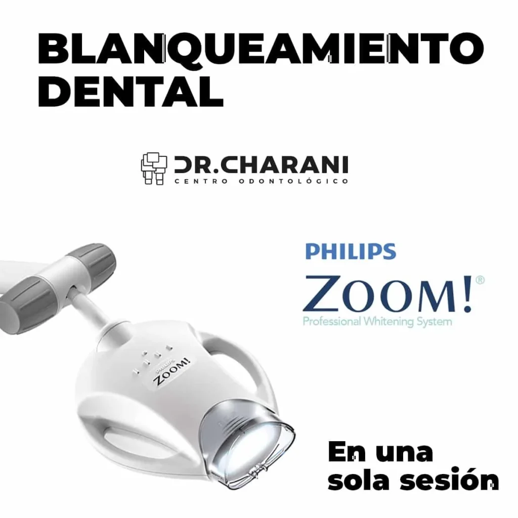 Blanqueamiento dental Valencia Prueba el blanqueamiento Philips Zoom
