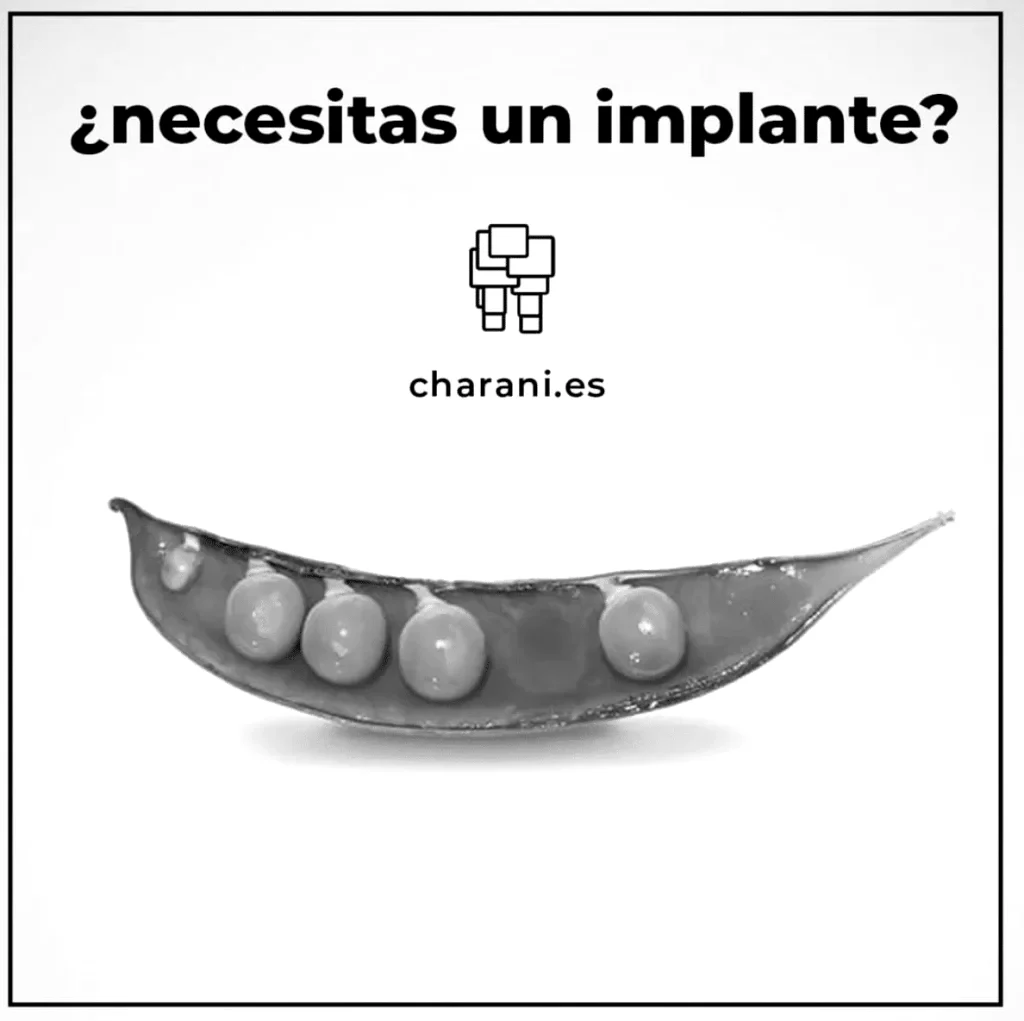 Lo último en implantamiento de dientes, adiós a la cirugía