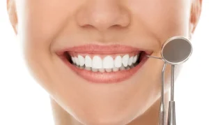 consejos blaqueamiento dental