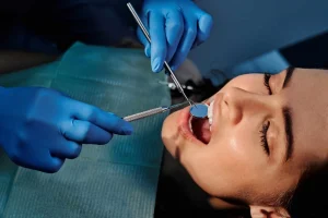 ¿Cómo elegir el mejor dentista?