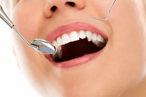 Cuáles son los nombres de los dientes y sus funciones