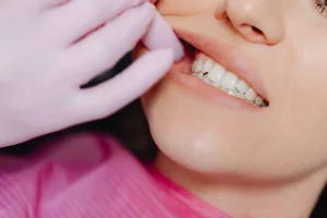 Invisalign en Valencia