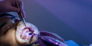 aparatos dentales