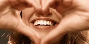 mejorar la sonrisa