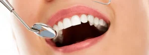 Revision sonrisa estetica - Casos reales | Clínica Dental Charani