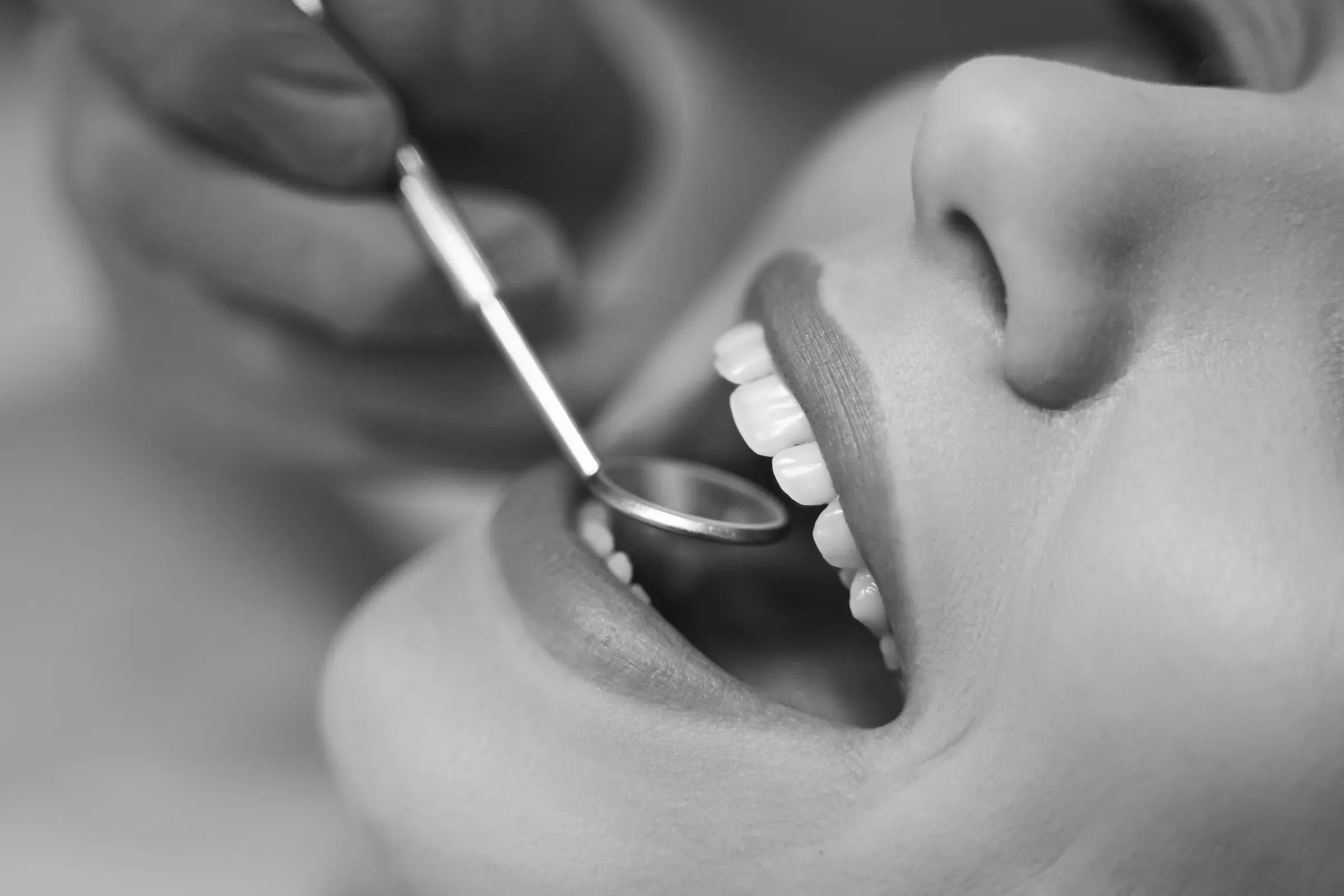 Estética dental en Valencia para mejorar el aspecto de tu sonrisa