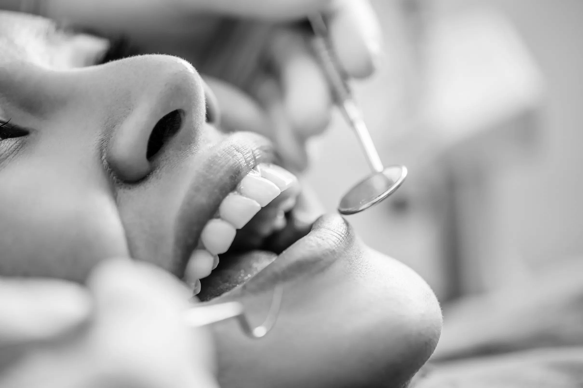 Estética dental en Valencia - Clínica Charani