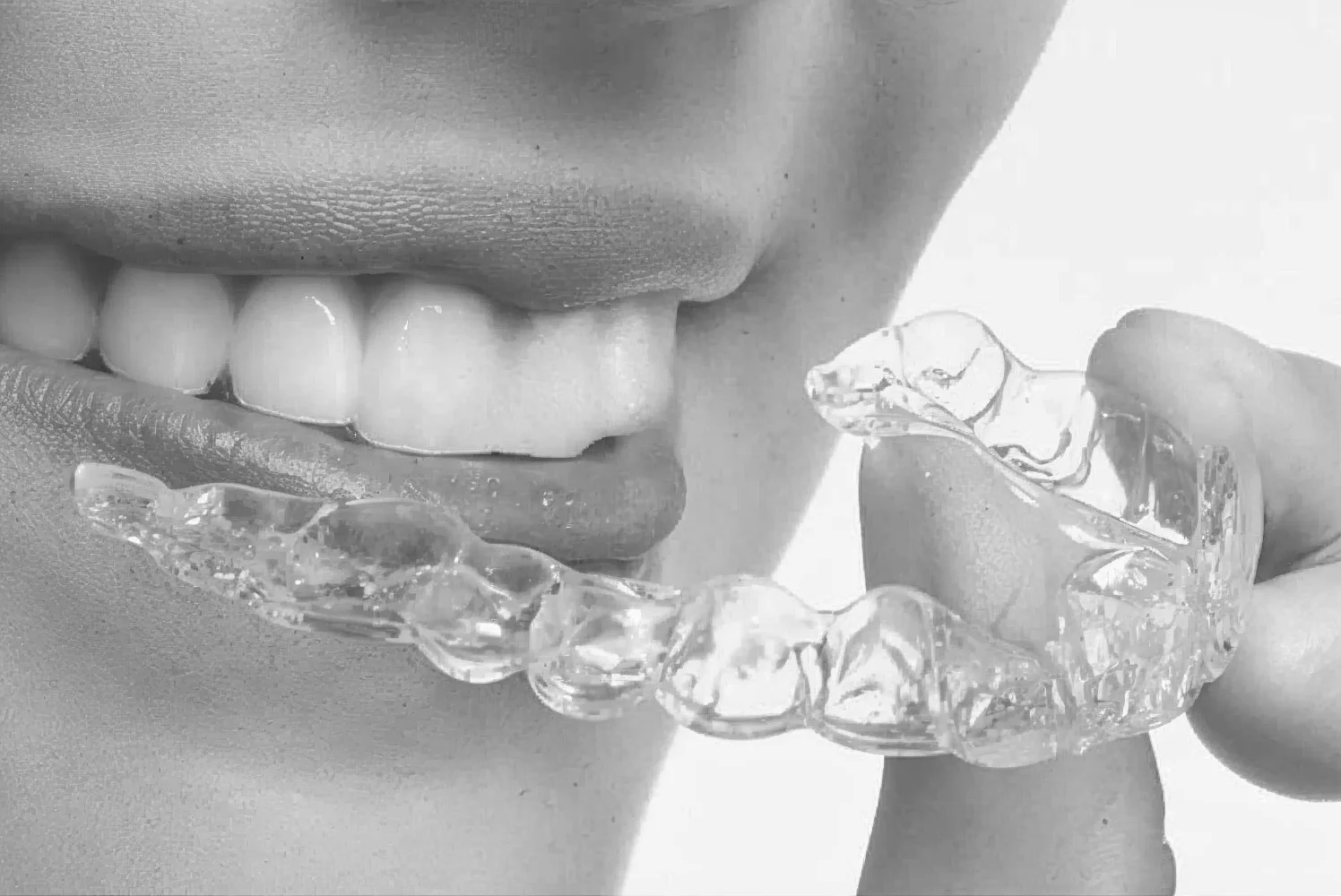 chica colocándose invisalign aparatos dentales invisibles