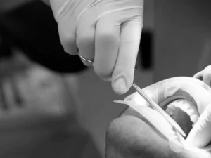 Cirugia dental valencia