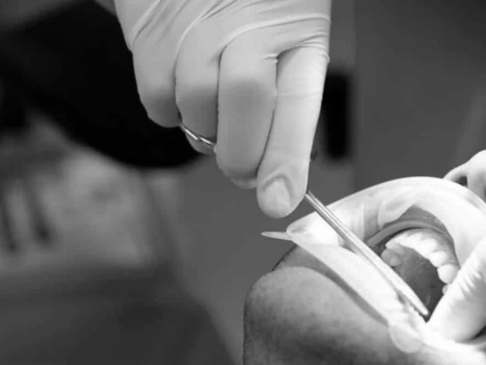Dentista realizando una cirugía dental a un paciente