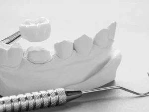 Coronas dentales en valencia clinica dental charani