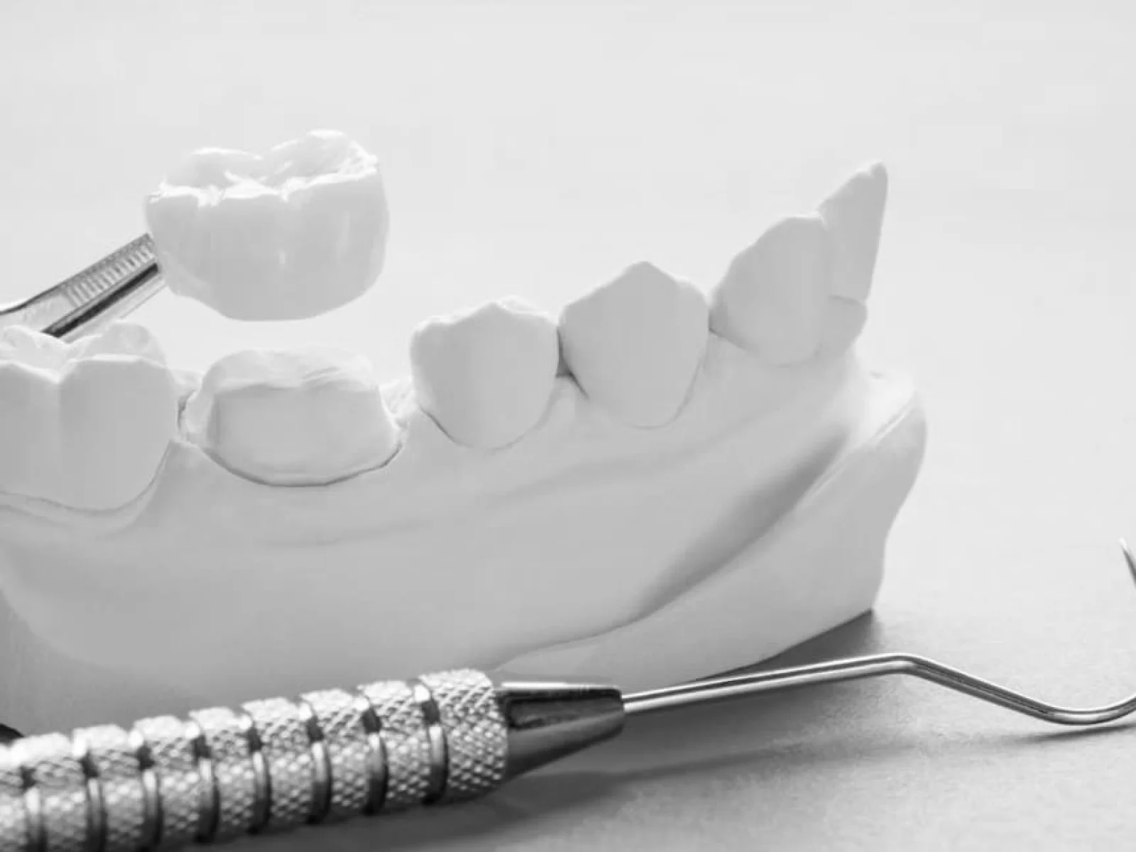 Coronas dentales en valencia clinica dental charani