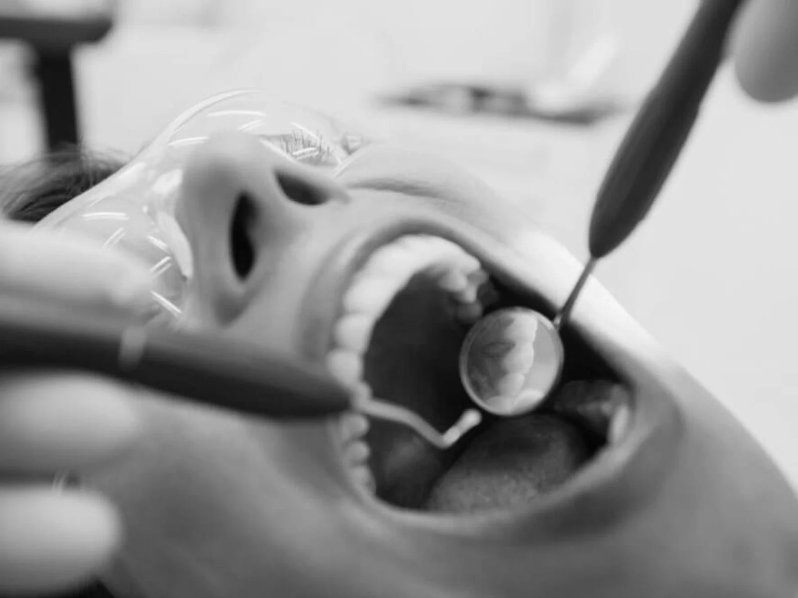 Dentista examinando la boca de un paciente para un curetaje