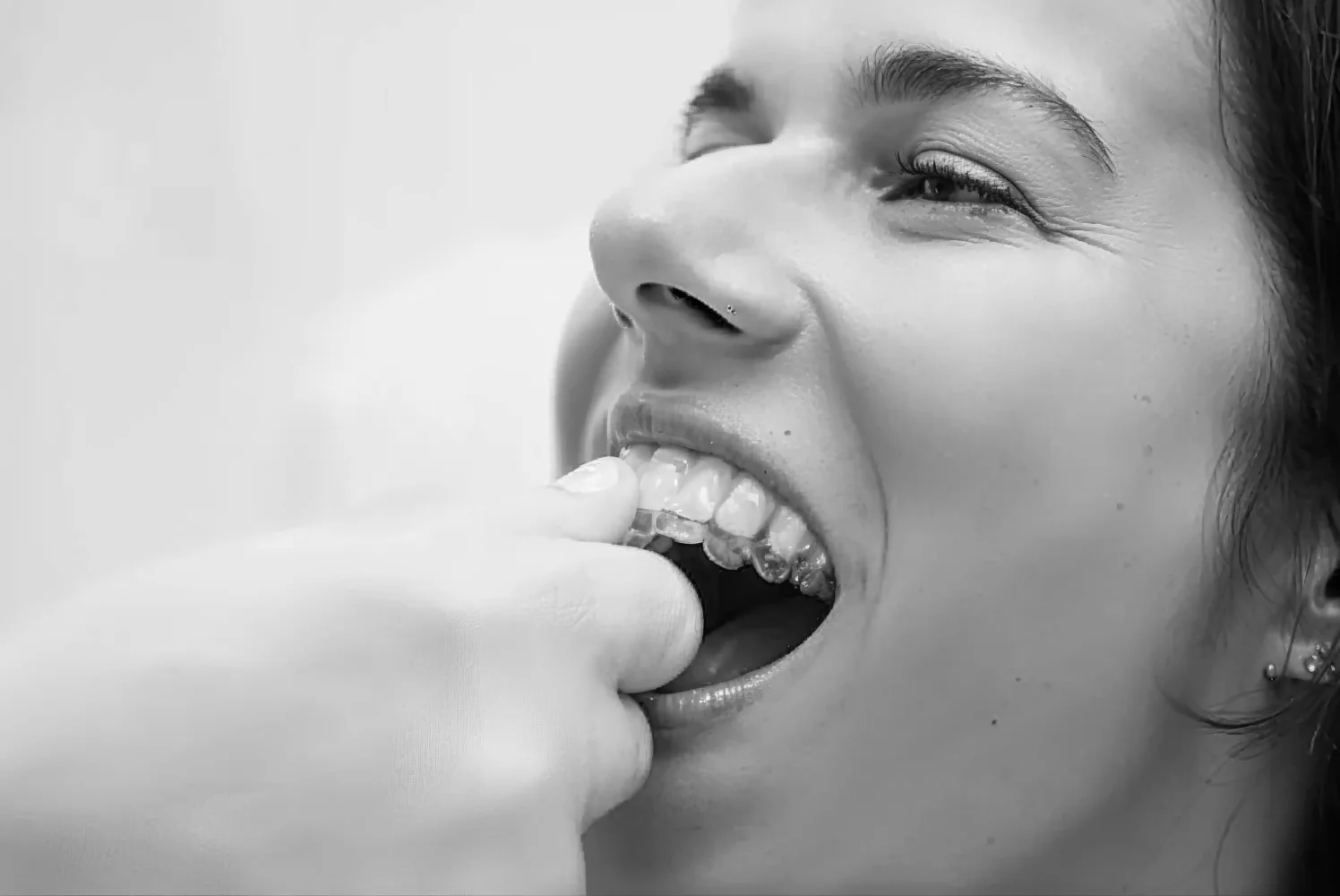 dentista que ayuda a paciente a colocarse ortodoncia invisible