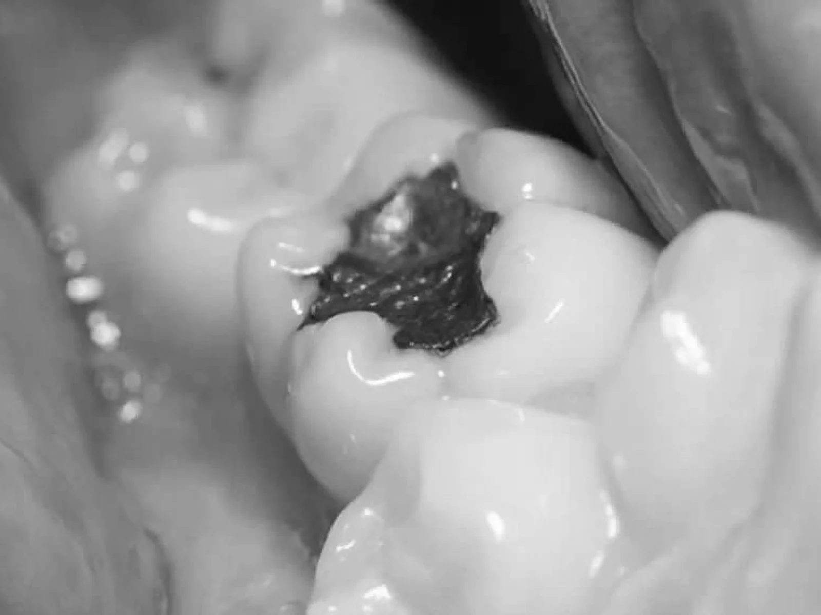 Interior de la boca con un empaste dental