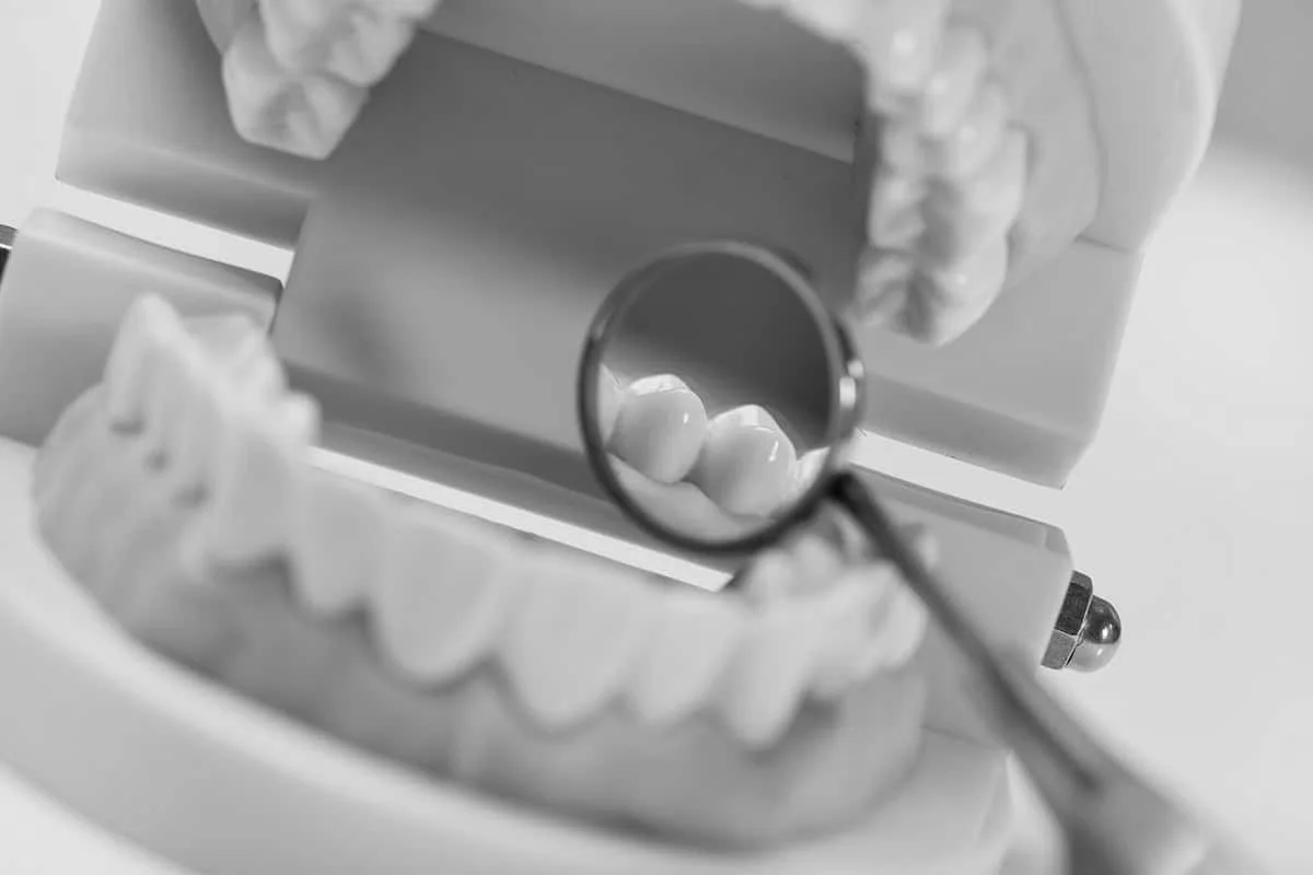 Implantes blancos Charani