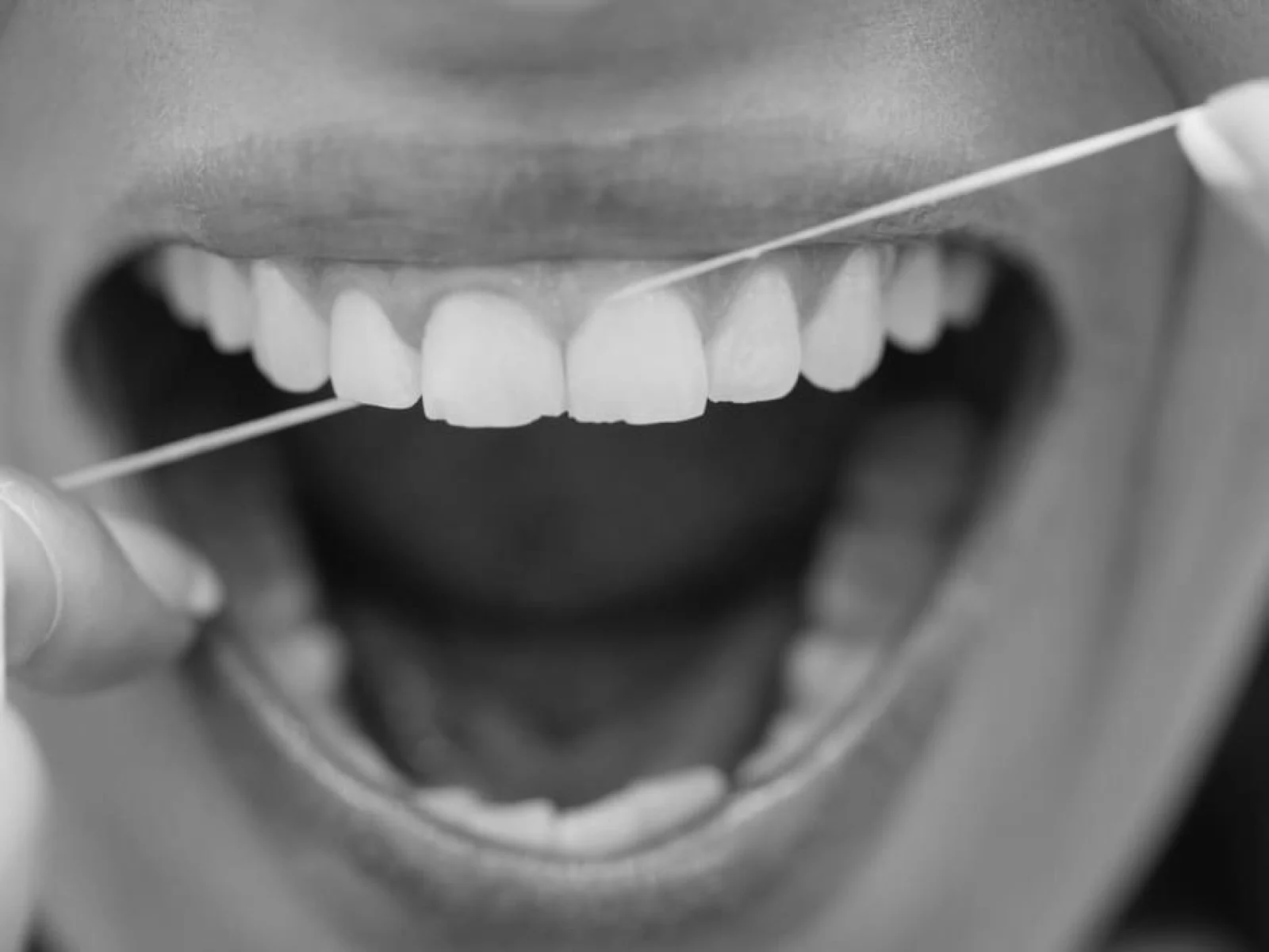 Paciente usando hilo dental tras una limpieza en Clínica Dental Charani