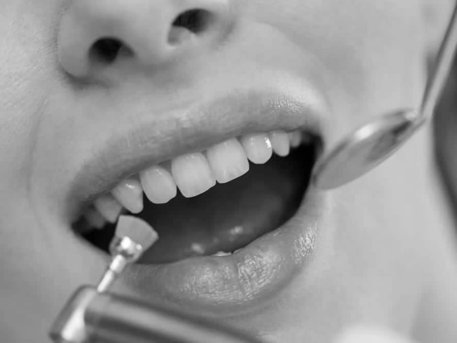 Higienista examinando al paciente durante una limpieza dental