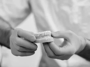 Puentes dentales