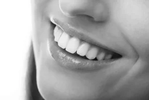 Sonrisa dientes blanqueados