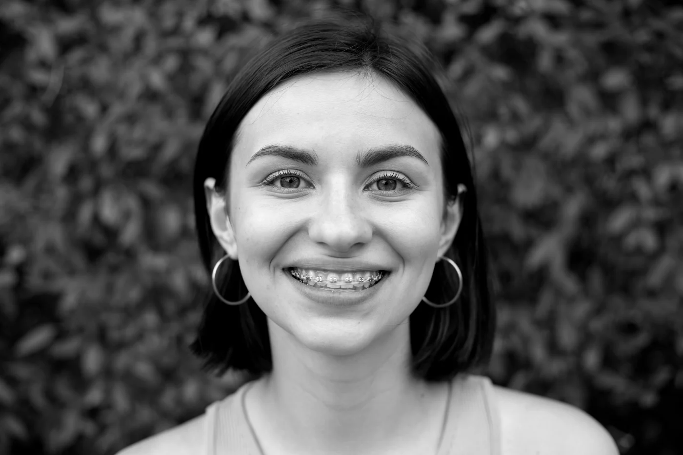 Ortodoncia en Manises - Clínica Dental Charani