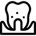 Periodontitis